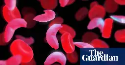 UK medicines regulator approves gene therapy for two blood disorders
